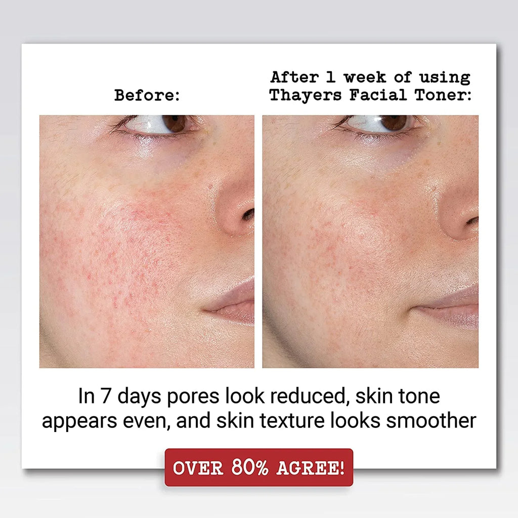 2 Lavender 12 Aloe Hazel Fl - Oz Witch (Pack - Thayers With of 2) Vera