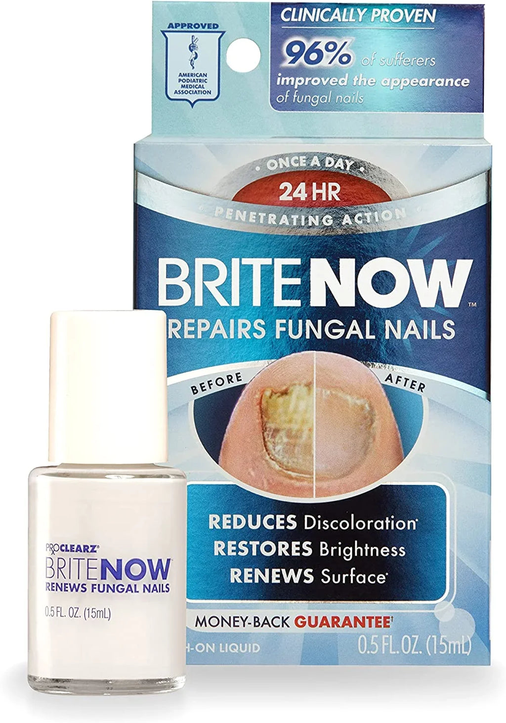 Now Smoothing Nail ProClearz 0.5 Discolored The Nails, Peel-Away Damaged Treatment, Brightening Appearance Ounce Restores Technology, & & Brite Repair, Nail Of