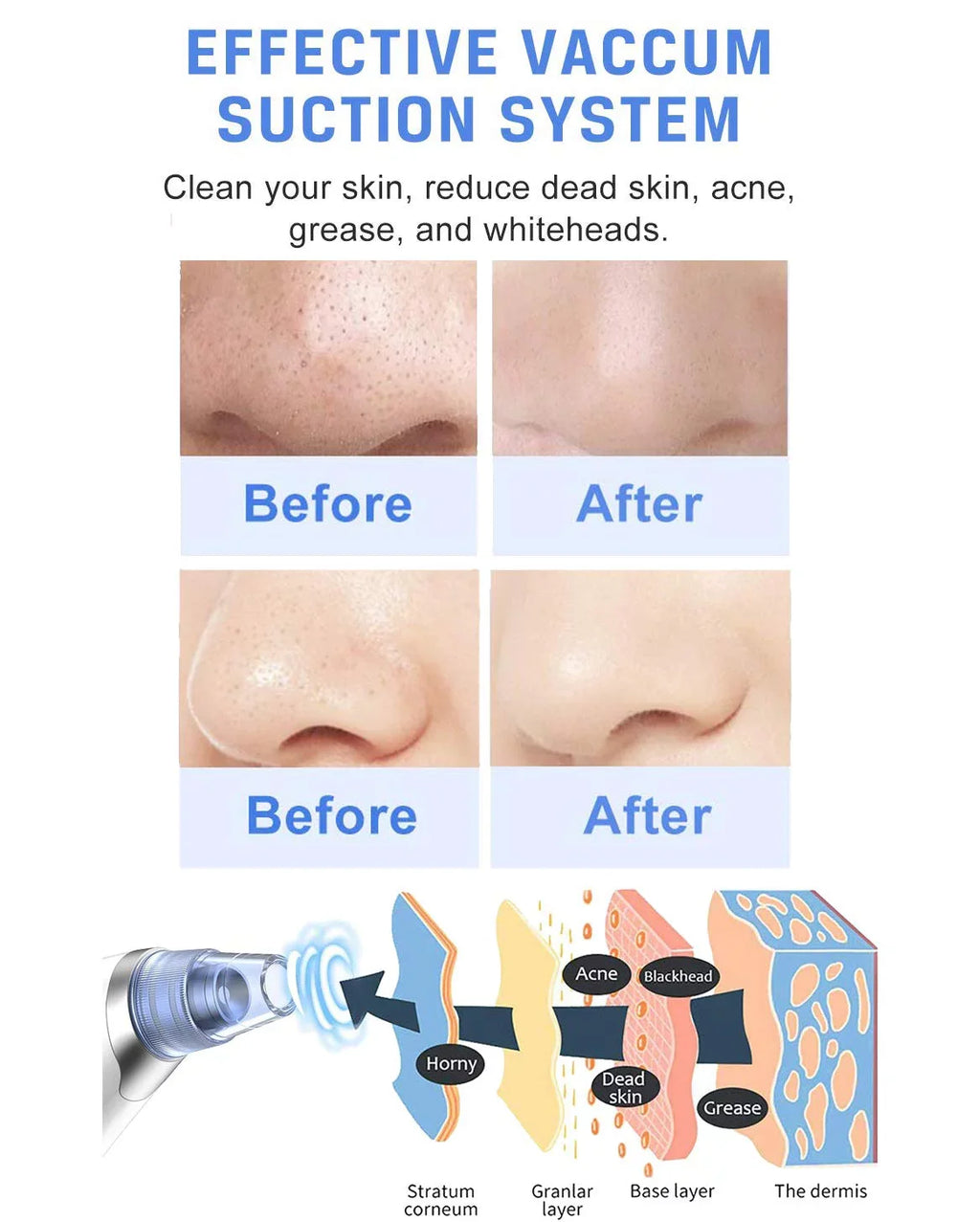 Face Face Rechargeable USB Blackhead Remover Electric Cleaner Vacuum Nose for Suction Blackhead Women Pimple Ansten Pore kit Facial Blackhead Men Sucker Cleaner Vacuum Remover Pore Pore