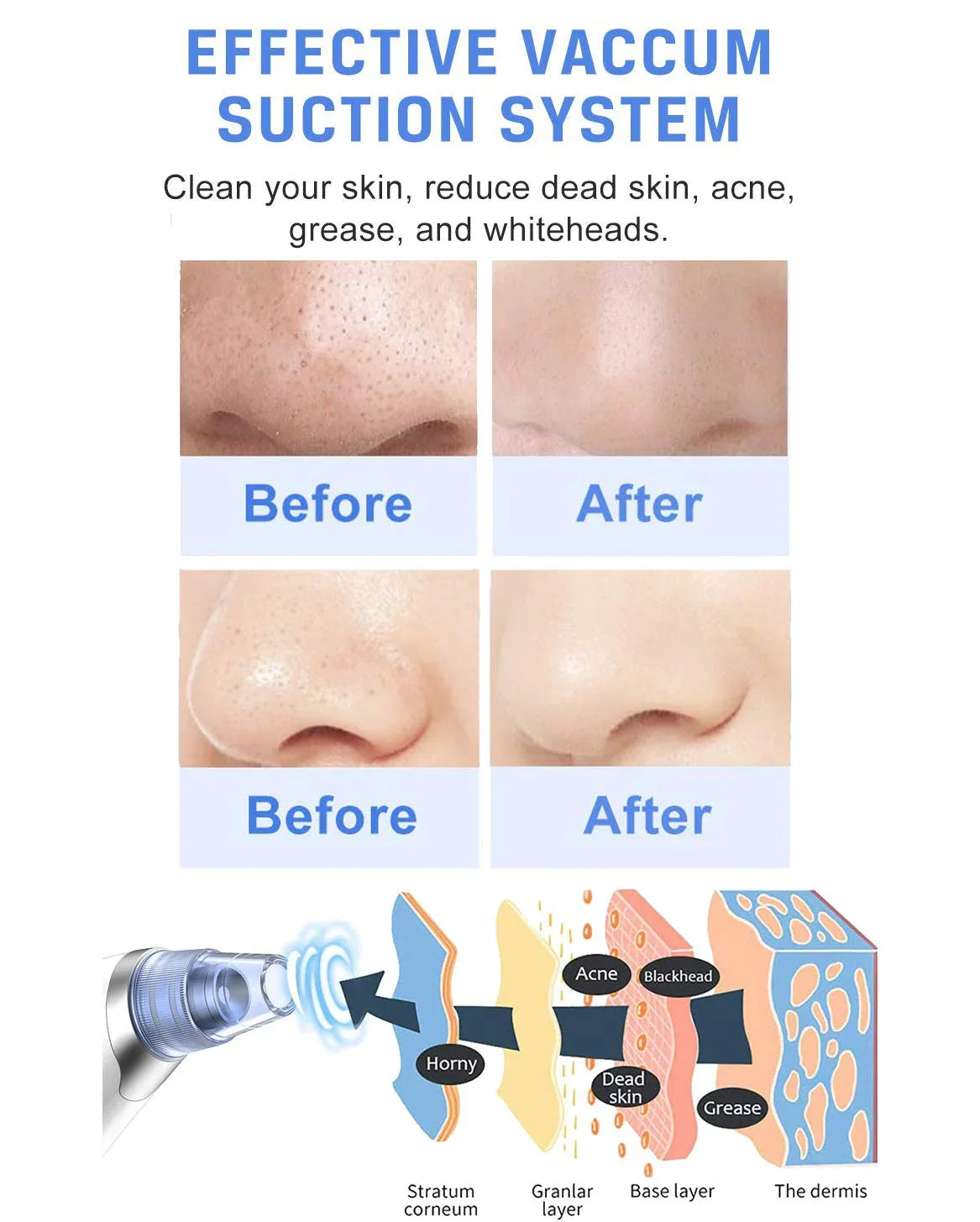 Face Face Rechargeable USB Blackhead Remover Electric Cleaner Vacuum Nose for Suction Blackhead Women Pimple Ansten Pore kit Facial Blackhead Men Sucker Cleaner Vacuum Remover Pore Pore